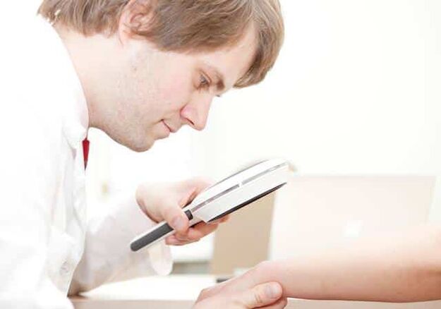 Diagnostic du psoriasis par un dermatologue.